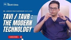 Best Treatment of Aortic Stenosis