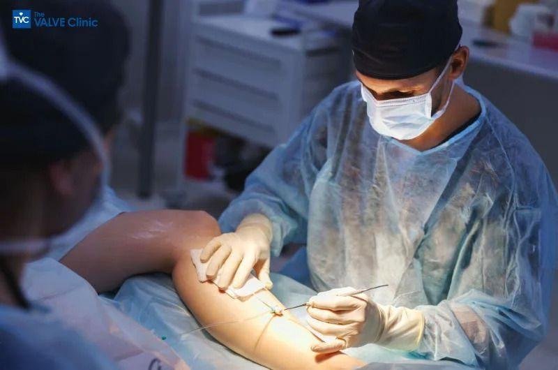 balloon-mitral-valvuloplasty